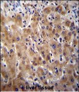 IHC-P - Glypican 3 (GPC3) Antibody (N-term) AP6337a